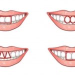 前歯の形でわかる性格判断…意外と当たってると話題に…